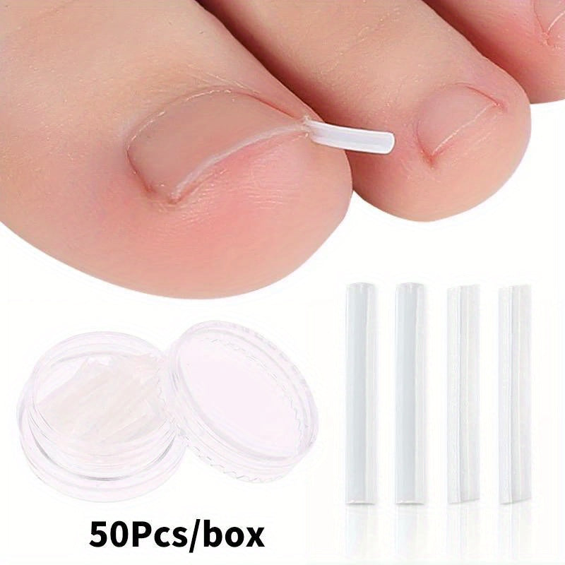 50Pcs Ingrown Toenail Correction Tool, Ingrown Toe NailElastic Patch Sticker, Straightening Clip Brace Pedicure Tool