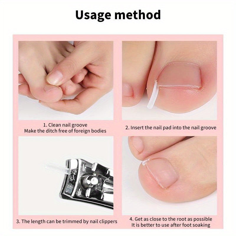 50Pcs Ingrown Toenail Correction Tool, Ingrown Toe NailElastic Patch Sticker, Straightening Clip Brace Pedicure Tool