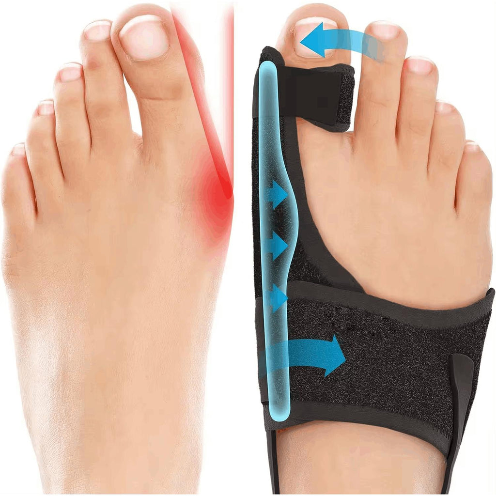 Bunion Corrector For Women Men Big Toe 1 Pair, Adjustable Bunion Splint With 2 Angle Bar, Toe Straightener With Double Non-slip Strap For Day Night Support