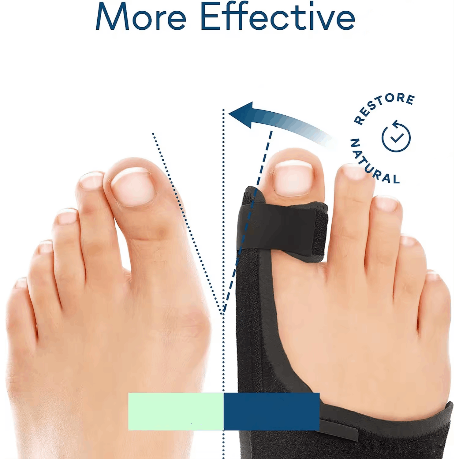 Bunion Corrector For Women Men Big Toe 1 Pair, Adjustable Bunion Splint With 2 Angle Bar, Toe Straightener With Double Non-slip Strap For Day Night Support